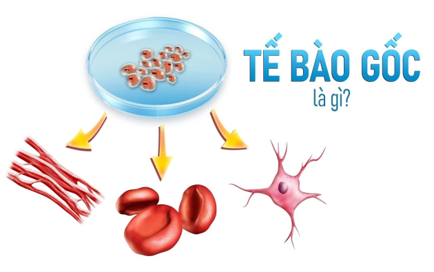 Tiêm tế bào gốc Nhật Bản: Có hiệu quả như lời đồn