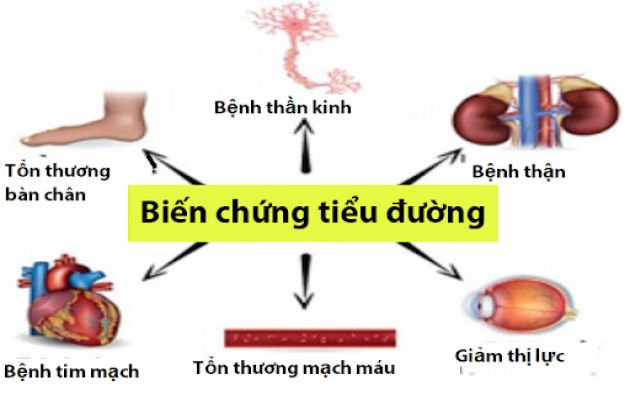 4 cấp độ dự phòng bệnh đái tháo đường